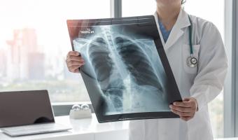Ärztin diagnostiziert Asthma, Lungenerkrankung, COPD oder Knochenkrebs-Erkrankung mit radiologischem Röntgenfilm zur Brustdiagnostik für medizinische Krankenhausversorgung
